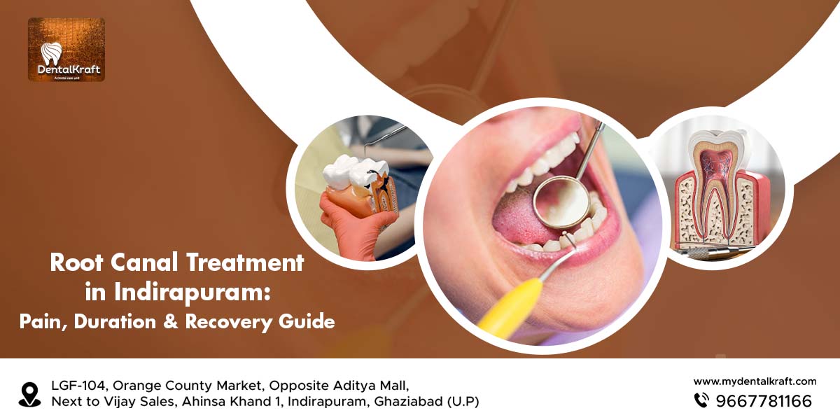 Root Canal Treatment in Indirapuram